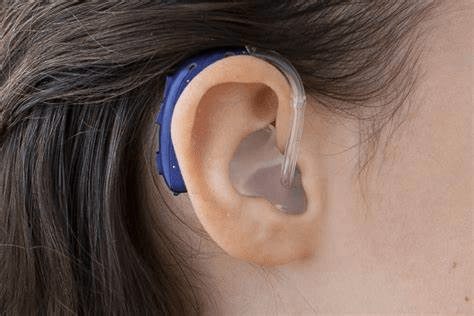 blue behind the ear hearing aid with solid earmold in ear